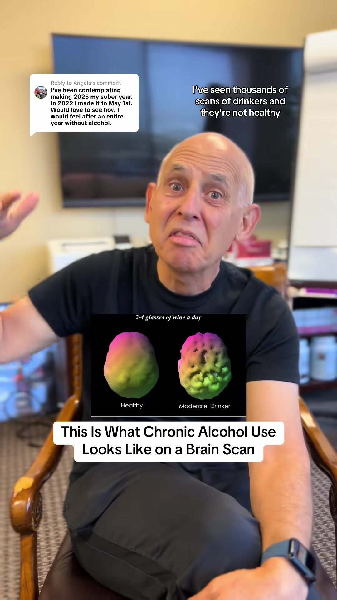 Replying to @Angela Alcohol use on a brain SPECT scan 🧠 know the truth 